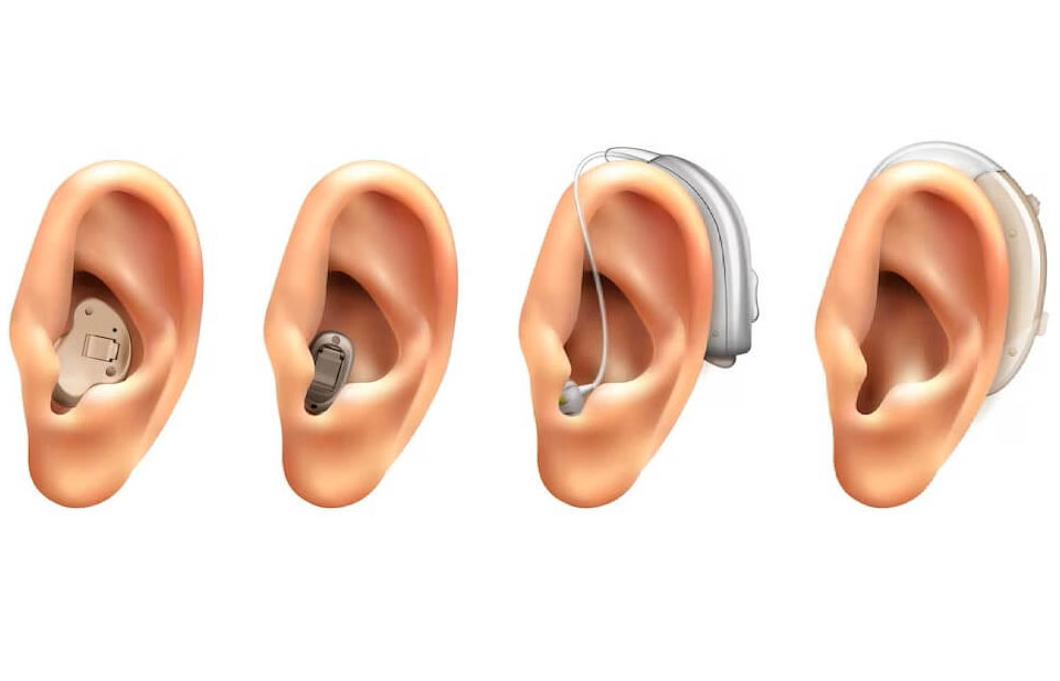 Kulak Arkası İşitme Cihazları Nedir ?